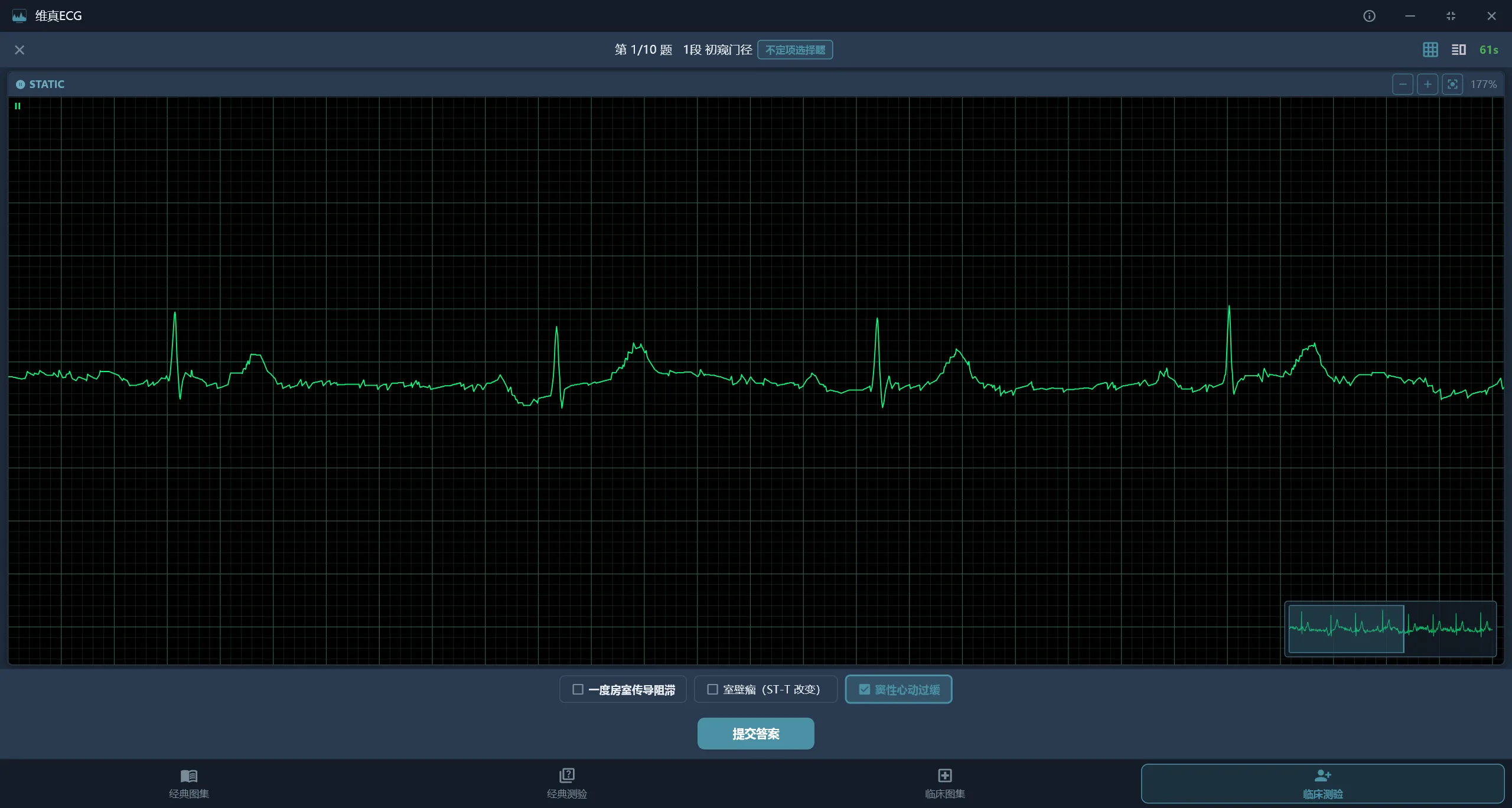 维真ECG 段位挑战答题界面